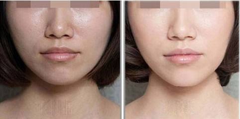 光子<a href=http://m.f3bb6.cn/listinfo-770-0.html target=_blank class=infotextkey>嫩膚</a>的價格是多少