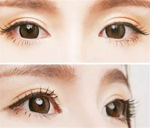   割<a href=http://m.f3bb6.cn/listinfo-724-0.html target=_blank class=infotextkey>雙眼皮</a>在哪里割好