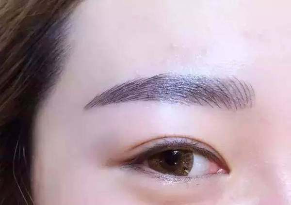 紋眉不可以吃什么東西