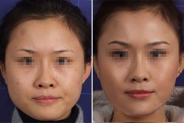 <a href=http://m.f3bb6.cn/listinfo-631-0.html target=_blank class=infotextkey>瘦臉</a><a href=http://m.f3bb6.cn/listinfo-614-0.html target=_blank class=infotextkey>除皺</a>抽煙影響效果嗎