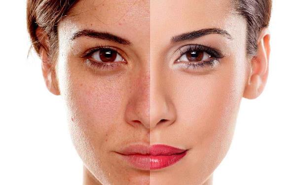 淮南臉部激光<a href=http://m.f3bb6.cn/listinfo-670-0.html target=_blank class=infotextkey>脫毛</a>價格