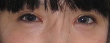 <a href=http://m.f3bb6.cn/listinfo-711-0.html target=_blank class=infotextkey>開眼角</a>增生了能恢復嗎