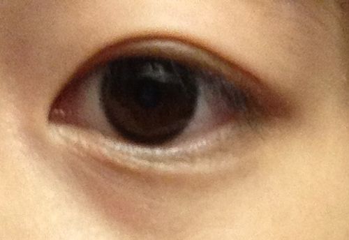 割<a href=http://m.f3bb6.cn/listinfo-724-0.html target=_blank class=infotextkey>雙眼皮</a>價錢高嗎 大概要多少錢