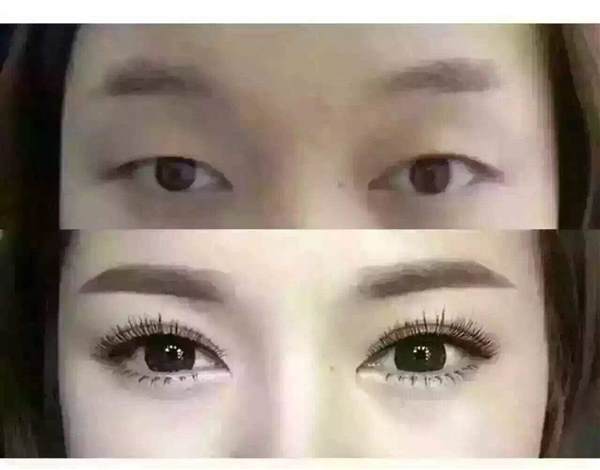 北京割<a href=http://m.f3bb6.cn/listinfo-724-0.html target=_blank class=infotextkey>雙眼皮</a>價格