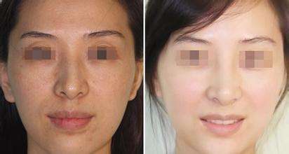 光子<a href=http://m.f3bb6.cn/listinfo-763-0.html target=_blank class=infotextkey><a href=http://m.f3bb6.cn/listinfo-770-0.html target=_blank class=infotextkey>嫩膚</a>美白</a>價(jià)格