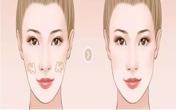 去手術疤痕的方法