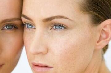 激光<a href=http://m.f3bb6.cn/listinfo-795-0.html target=_blank class=infotextkey>祛斑</a>后會不會反彈