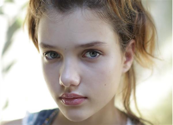 眼袋祛除失敗怎么修復