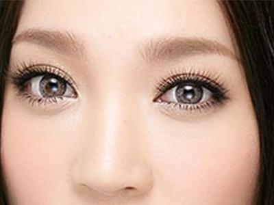 <a href=http://m.f3bb6.cn/listinfo-682-0.html target=_blank class=infotextkey>溶脂</a><a href=http://m.f3bb6.cn/listinfo-708-0.html target=_blank class=infotextkey>去眼袋</a>好不好呢