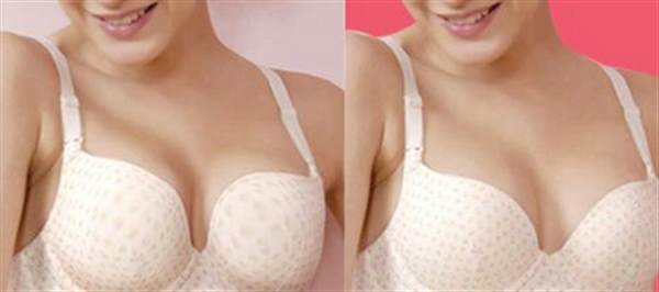 自體脂肪<a href=http://m.f3bb6.cn/listinfo-618-0.html target=_blank class=infotextkey>隆胸</a>多少錢