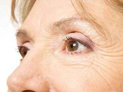 詳解中老年人可以割<a href=http://m.f3bb6.cn/listinfo-724-0.html target=_blank class=infotextkey>雙眼皮</a>嗎？