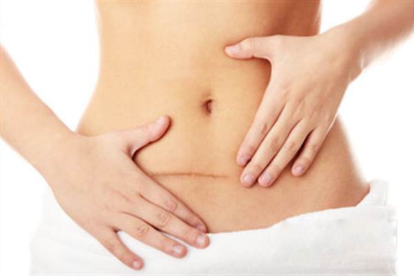 疤痕增生手術(shù)原因有哪些