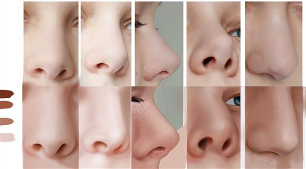 一個鼻部多項較貴多少錢