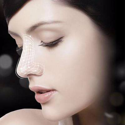 鼻子要打幾只透明質酸才有效