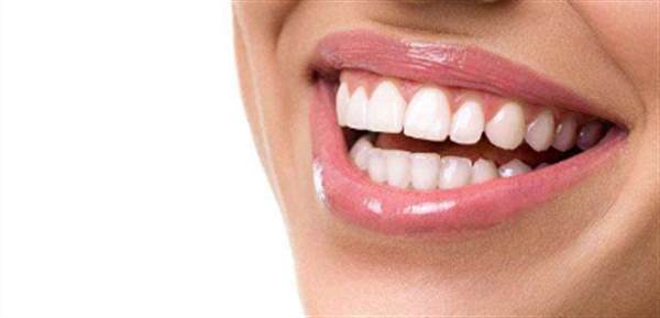 牙齒貼面有什么要求嗎