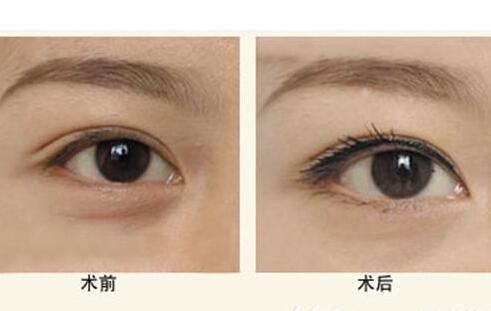 有眼袋怎么化妝遮住