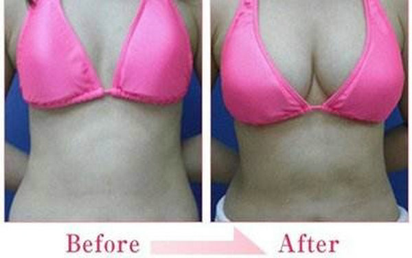 假體<a href=http://m.f3bb6.cn/listinfo-618-0.html target=_blank class=infotextkey>隆胸</a>受歡迎的原因