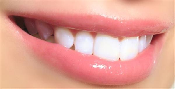 植牙該如何護(hù)理好