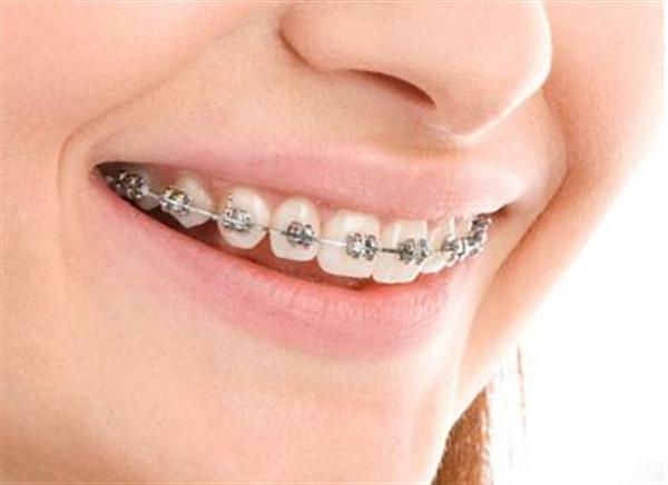 <a href=http://m.f3bb6.cn/listinfo-824-0.html target=_blank class=infotextkey>牙齒矯正</a>價格