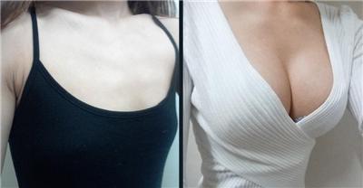 成都<a href=http://m.f3bb6.cn/listinfo-618-0.html target=_blank class=infotextkey>隆胸</a>禁忌人群有哪些