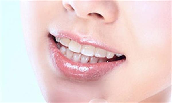 牙列不齊主要表現在哪些方面