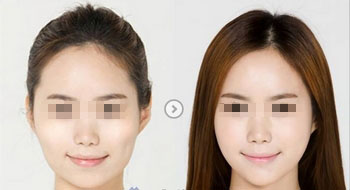 <a href=http://m.f3bb6.cn/listinfo-631-0.html target=_blank class=infotextkey>瘦臉</a><a href=http://m.f3bb6.cn/listinfo-614-0.html target=_blank class=infotextkey>除皺</a>多久有明顯效果