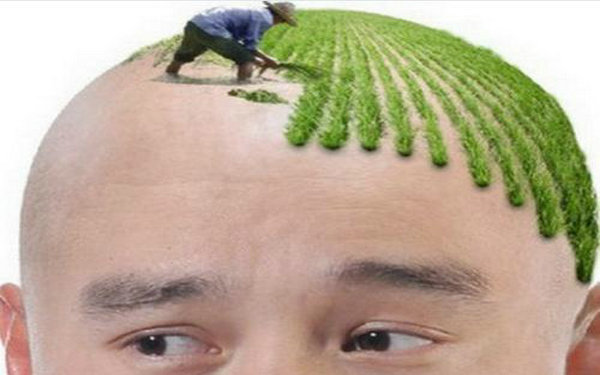 種植頭發是怎么種的？