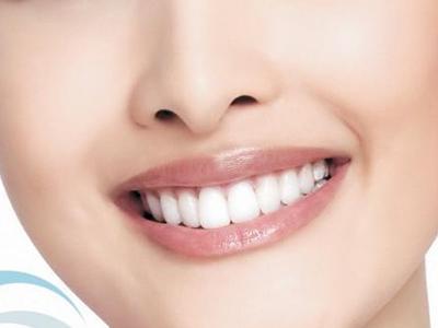 牙齒陶瓷矯正費用