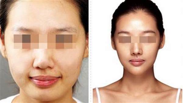 <a href=http://m.f3bb6.cn/listinfo-631-0.html target=_blank class=infotextkey>瘦臉</a><a href=http://m.f3bb6.cn/listinfo-614-0.html target=_blank class=infotextkey>除皺</a>多少錢