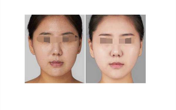 廣州彩光<a href=http://m.f3bb6.cn/listinfo-763-0.html target=_blank class=infotextkey><a href=http://m.f3bb6.cn/listinfo-770-0.html target=_blank class=infotextkey>嫩膚</a>美白</a>后的護理要注意什么