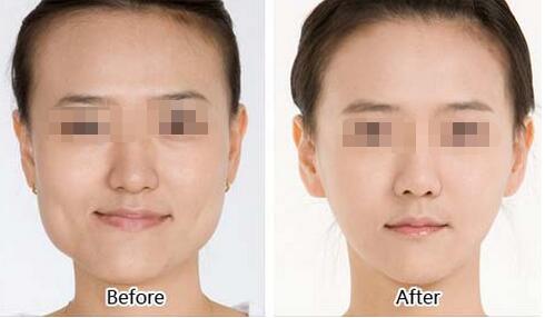 <a href=http://m.f3bb6.cn/listinfo-631-0.html target=_blank class=infotextkey>瘦臉</a><a href=http://m.f3bb6.cn/listinfo-614-0.html target=_blank class=infotextkey>除皺</a>為什么不能抽煙