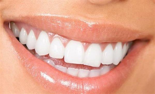 牙列稀疏要怎樣矯正