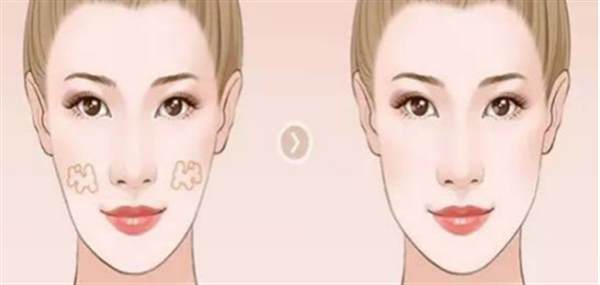 開刀后疤痕庝痛怎么辦