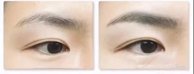 有月經(jīng)時紋眉了怎么辦