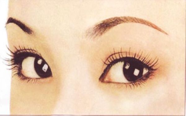 內(nèi)眼角修復(fù)容易嗎