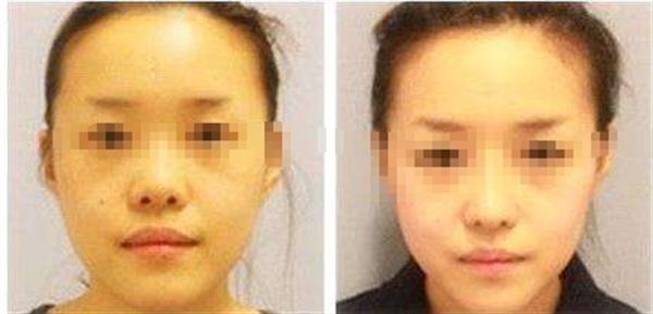 方臉瘦下來成什么樣子