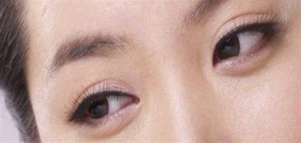 眼皮打透明質酸可以打成<a href=http://m.f3bb6.cn/listinfo-724-0.html target=_blank class=infotextkey>雙眼皮</a>嗎