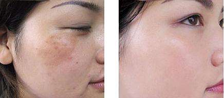 牙膏加什么可快速<a href=http://m.f3bb6.cn/listinfo-795-0.html target=_blank class=infotextkey>祛斑</a>