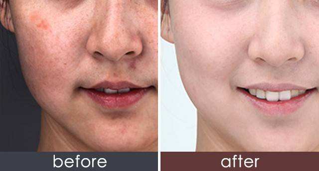 牙膏<a href=http://m.f3bb6.cn/listinfo-795-0.html target=_blank class=infotextkey>祛斑</a>的正確方法