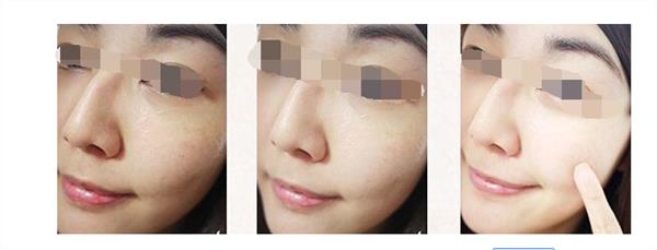 彩光<a href=http://m.f3bb6.cn/listinfo-770-0.html target=_blank class=infotextkey>嫩膚</a>術后需要注意哪些事項呢