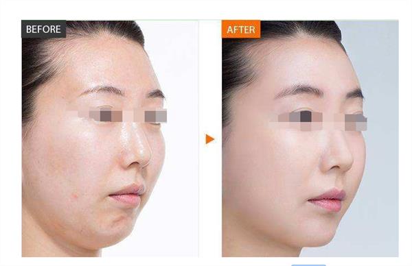 做彩光<a href=http://m.f3bb6.cn/listinfo-770-0.html target=_blank class=infotextkey>嫩膚</a>美容手術有哪些好處呢