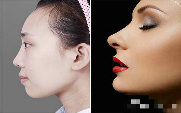 做假體<a href=http://m.f3bb6.cn/listinfo-737-0.html target=_blank class=infotextkey>隆鼻</a>要多少錢？