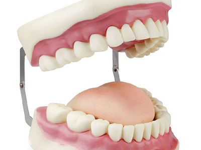 鑲滿口假牙多少錢