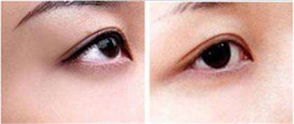 如何<a href=http://m.f3bb6.cn/listinfo-712-0.html target=_blank class=infotextkey>洗眼線</a>