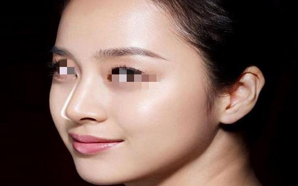 注射透明質酸<a href=http://m.f3bb6.cn/listinfo-737-0.html target=_blank class=infotextkey>隆鼻</a>的過程?