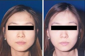 <a href=http://m.f3bb6.cn/listinfo-631-0.html target=_blank class=infotextkey>瘦臉</a><a href=http://m.f3bb6.cn/listinfo-614-0.html target=_blank class=infotextkey>除皺</a>多久能彎腰洗頭