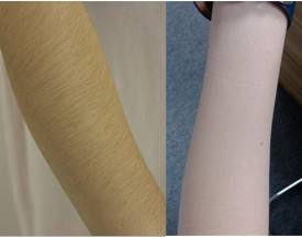 激光<a href=http://m.f3bb6.cn/listinfo-670-0.html target=_blank class=infotextkey>脫毛</a>有效果嗎