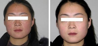 彩光<a href=http://m.f3bb6.cn/listinfo-763-0.html target=_blank class=infotextkey><a href=http://m.f3bb6.cn/listinfo-770-0.html target=_blank class=infotextkey>嫩膚</a>美白</a>的原理是什么