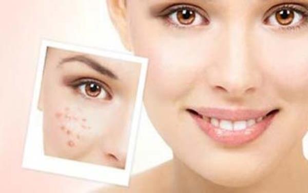 e光去痘印管用嗎