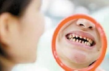 牙齒稀疏矯正多少錢